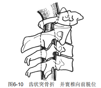 6-10.png