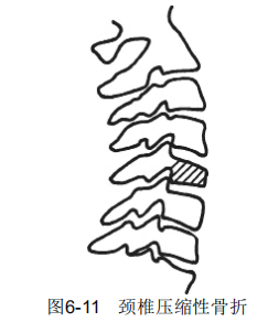 6-11.png