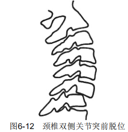 6-12png.png
