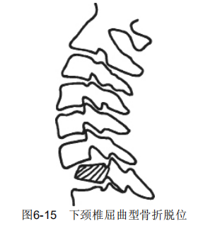 6-15.png
