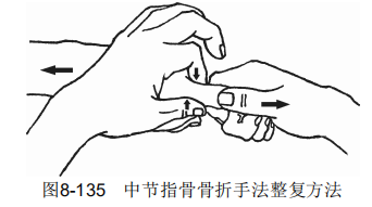 8-135.png