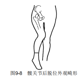 9-8.png