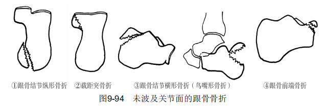 9-94.png